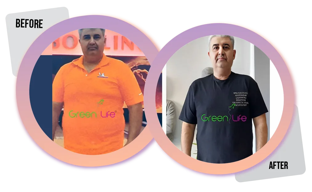 نتایج لاغری موضعی با دستگاه 