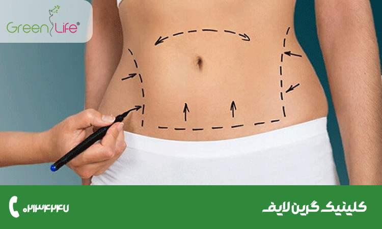 سریع ترین راه لاغری شکم و پهلو با طب سنتی