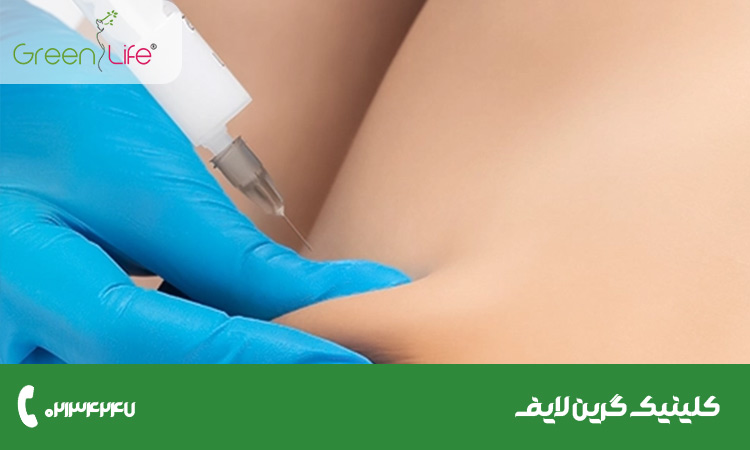 عوارض و خطرات احتمالی مزوتراپی لاغری - کلینیک گرین لایف 