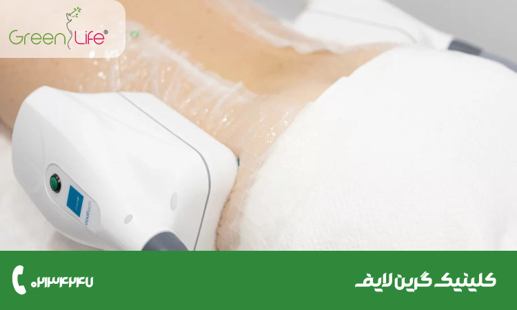 لاغری با دستگاه کول تک چیست - کلینیک گرین لایف