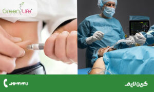 مقایسه عمل اسلیو معده و آمپول لاغری | کدام روش برای کاهش وزن بهتر است؟