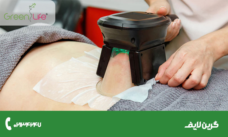 چگونه می توان از برگشت چربی بعد از لاغری با دستگاه جلوگیری کرد؟