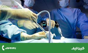 معرفی انواع عمل لاغری شکم