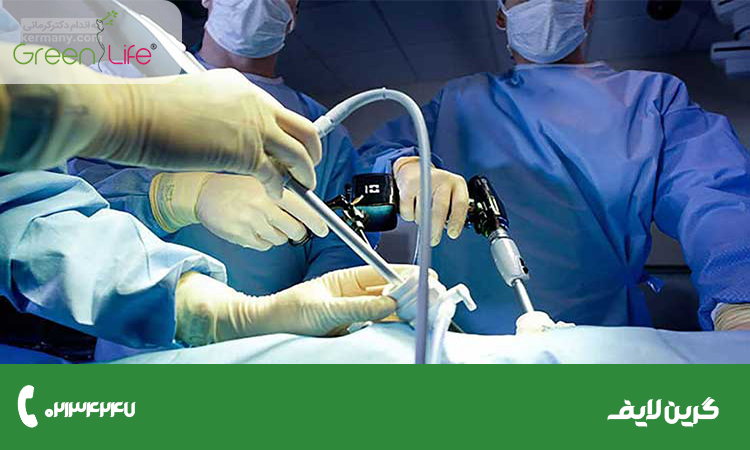 معرفی انواع عمل لاغری شکم